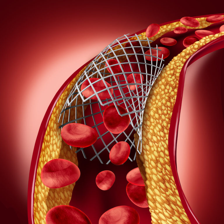 Demystifying LDL and HDL – the bad and good cholesterol