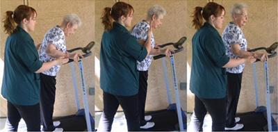 A hip fracture patient walking on a treadmill