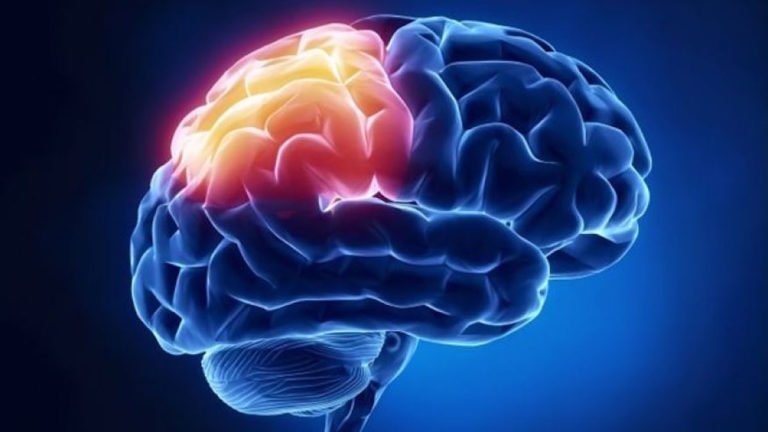 Brain cells of multiple sclerosis patients age faster, act older