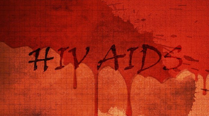 hiv-AIDS
