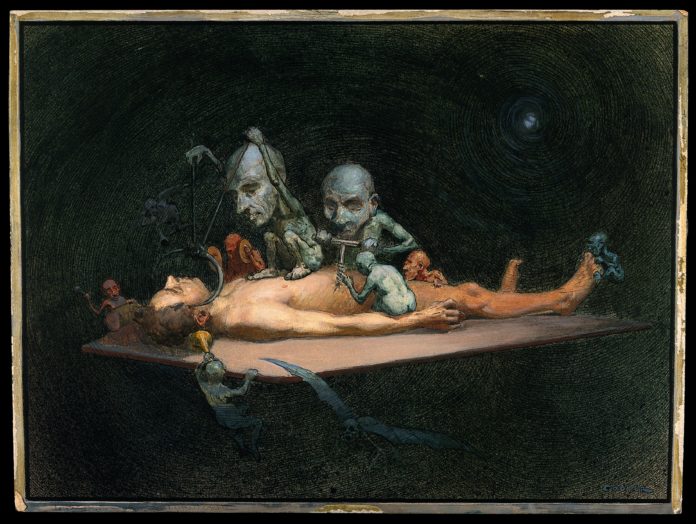 An unconscious naked man lying on a table being attacked by little demons armed with surgical instruments; symbolising the effects of chloroform on the human body.