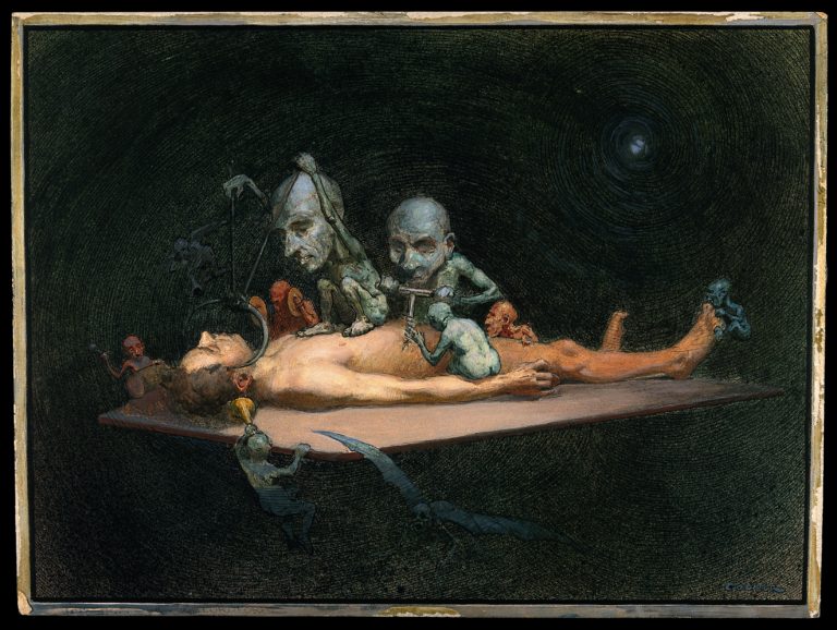 An unconscious naked man lying on a table being attacked by little demons armed with surgical instruments; symbolising the effects of chloroform on the human body.