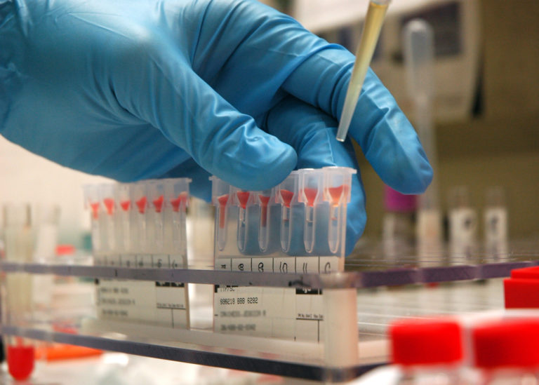 Johns Hopkins scientists develop single blood test CancerSEEK for 8 cancers