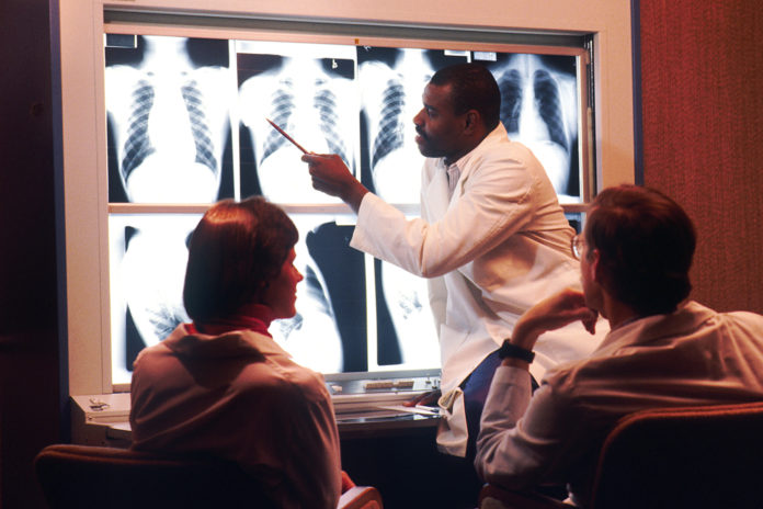 Radiologist examines chest x-rays