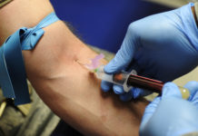 blood test for hepatitis C