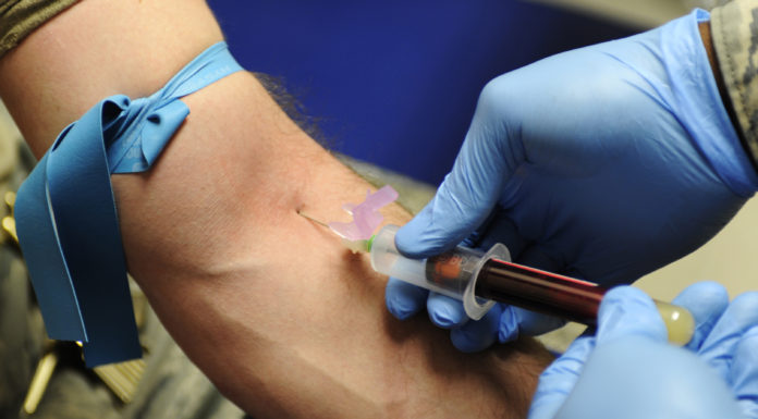 blood test for hepatitis C