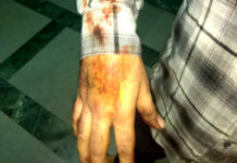 A Doctor who was beaten up