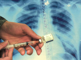 TB vaccine