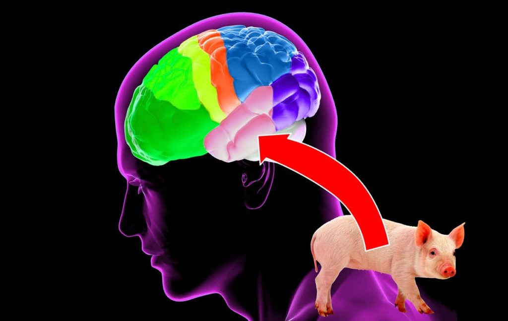 Neurocystercosis, pig, pork, human brain