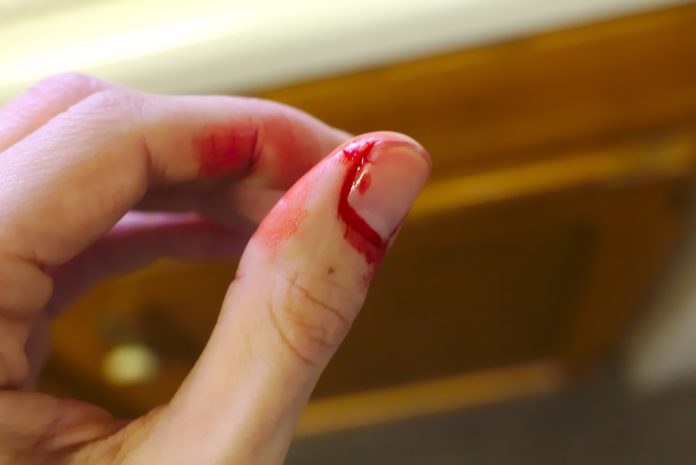 blood bleeding
