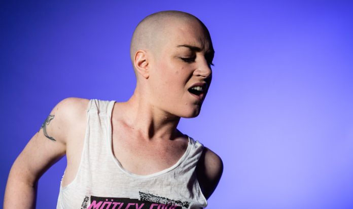 A woman suffering from baldness