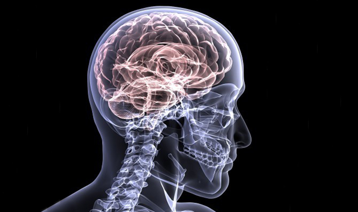 Globally one in four people over 25 yrs has significant stroke risk