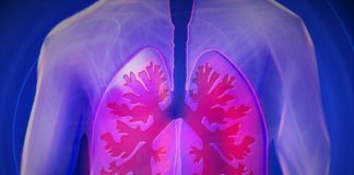 Lungs, respiratory disease, COPD