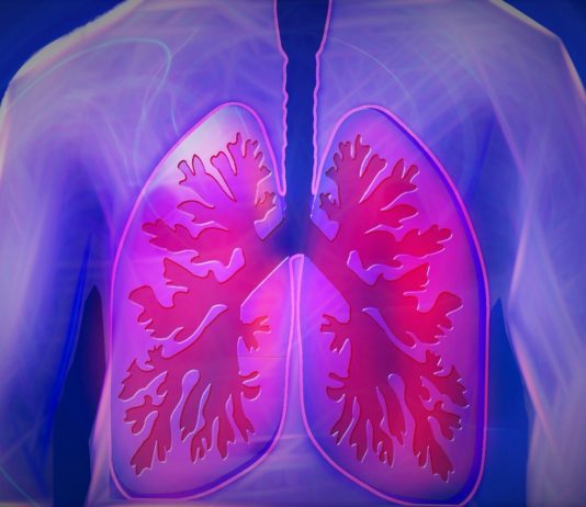 Lungs, respiratory disease, COPD