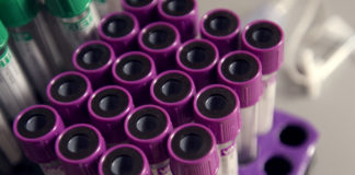 Liquid biopsy shows cancer response