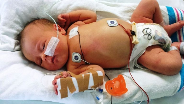 Why babies are dying? We are just not ready enough