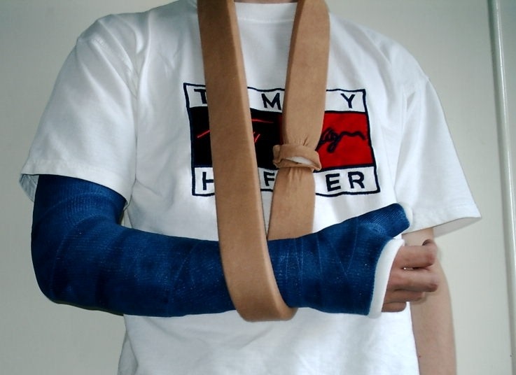 3 weeks in a sling as good as a surgery for displaced shoulder